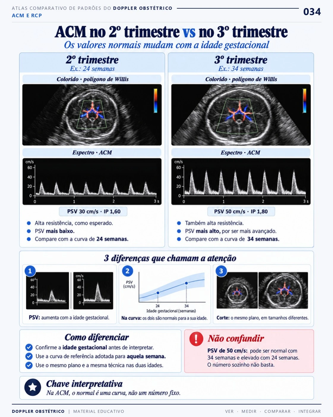 Página 34: ACM no segundo e no terceiro trimestre. Trecho do PDF de Doppler Obstétrico e Fetal.