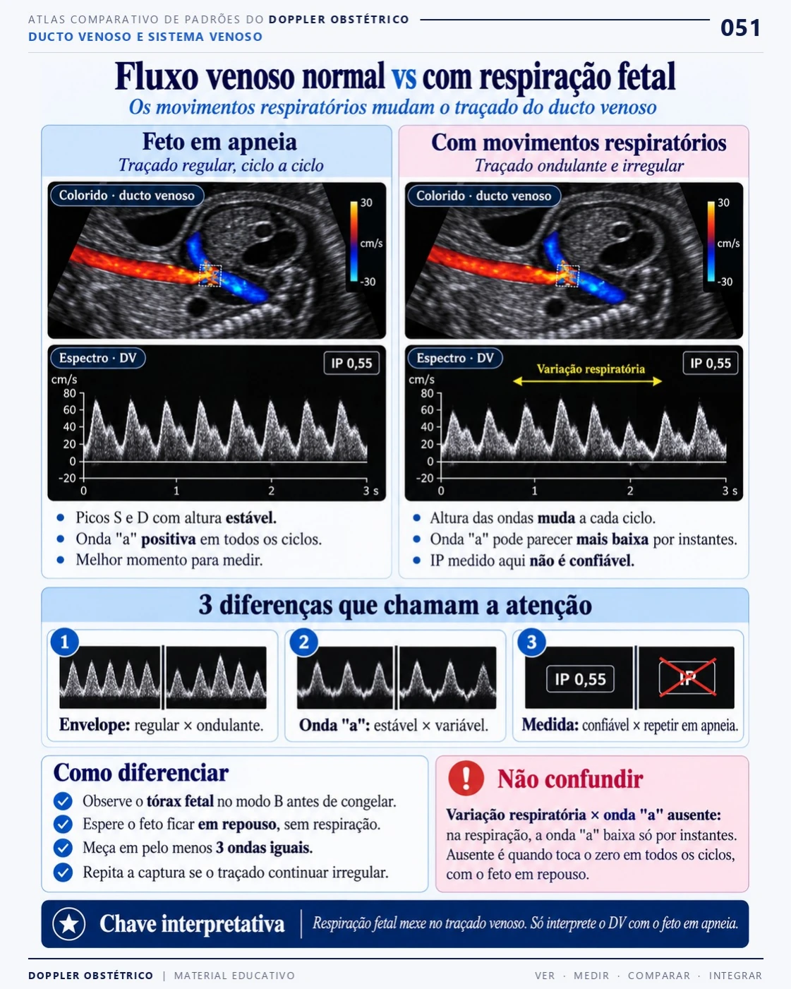 Página 51: Fluxo venoso e respiração fetal. Trecho do PDF de Doppler Obstétrico e Fetal.