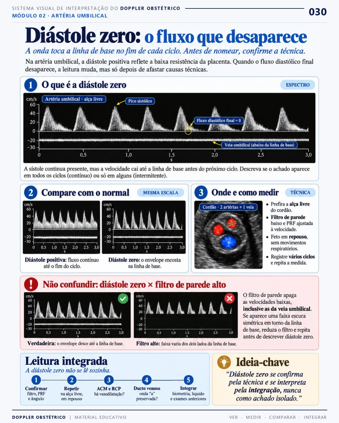 Página 30: Diástole zero: o fluxo que desaparece. Trecho do PDF de Doppler Obstétrico e Fetal.