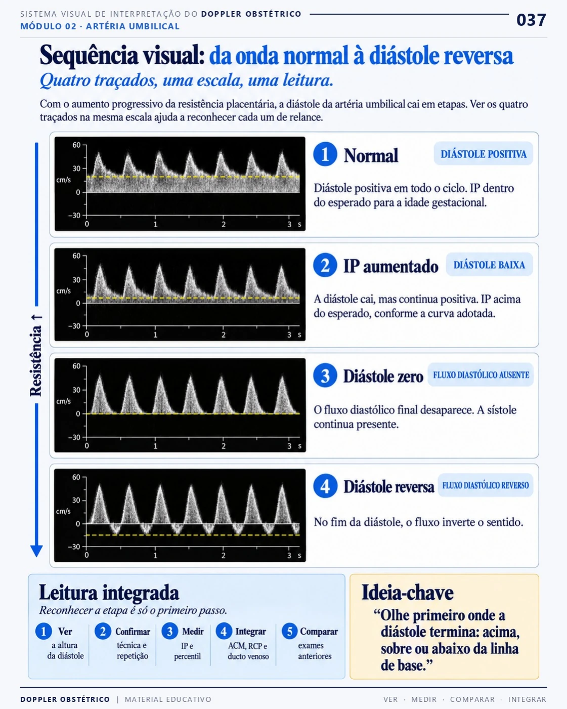 Página 37: sequência visual da onda normal à diástole reversa